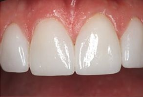 Smile Dental Office, PC | Periodontal Treatment, Invisalign and Dental Fillings