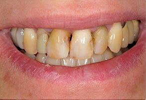 Smile Dental Office, PC | TMJ Disorders, Periodontal Treatment and Implant Dentistry